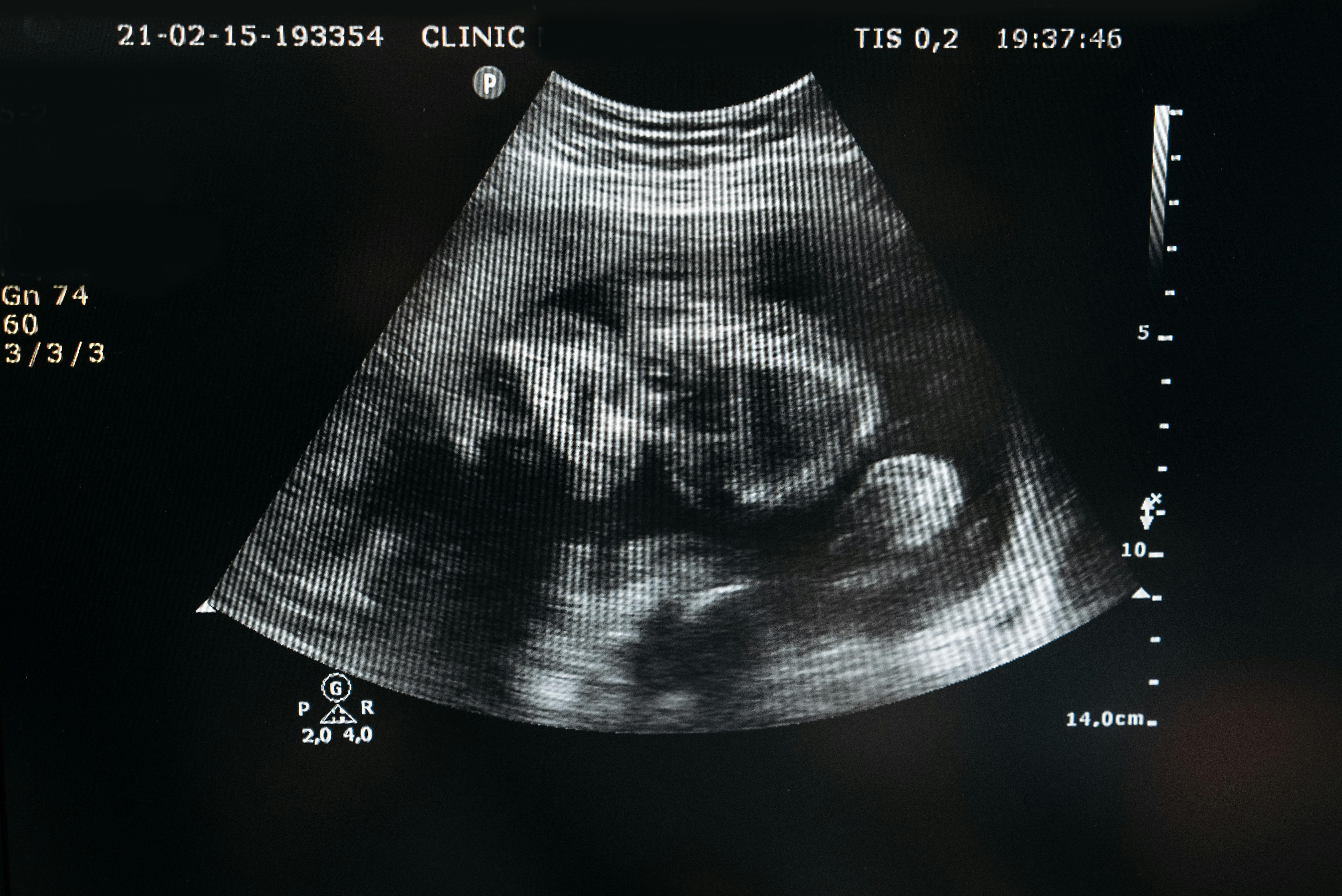 OB/GYN Services service at Heegan Medical Center